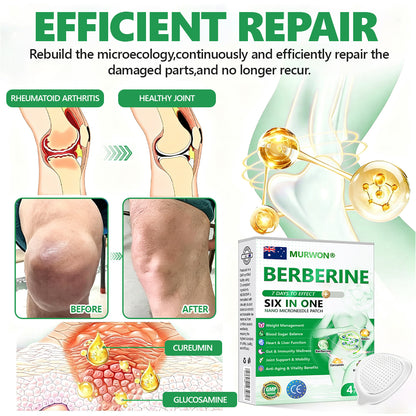 𝐀𝐮𝐬𝐬𝐢𝐞 𝐃𝐨𝐜𝐭𝐨𝐫 𝐑𝐞𝐜𝐨𝐦𝐦𝐞𝐧𝐝𝐞𝐝 👨‍⚕️ | 𝑴𝑼𝑹𝑾𝑶𝑵® 𝗕𝗲𝗿𝗯𝗲𝗿𝗶𝗻𝗲 𝟲-𝗶𝗻-𝟭 𝗡𝗮𝗻𝗼 𝗠𝗶𝗰𝗿𝗼𝗻𝗲𝗲𝗱𝗹𝗲 𝗣𝗮𝘁𝗰𝗵 👑| 𝐴𝑑𝑣𝑎𝑛𝑐𝑒𝑑 6-𝑖𝑛-1 𝑓𝑜𝑟𝑚𝑢𝑙𝑎 | ✨ 𝑉𝑖𝑠𝑖𝑏𝑙𝑒 𝑟𝑒𝑠𝑢𝑙𝑡𝑠 𝑖𝑛 𝑎𝑠 𝑙𝑖𝑡𝑡𝑙𝑒 𝑎𝑠 7 𝑑𝑎𝑦𝑠 💕