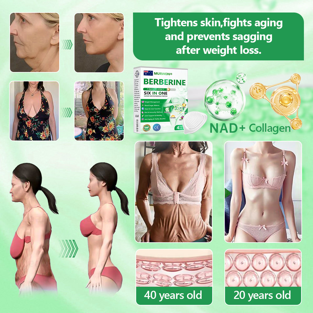 𝐀𝐮𝐬𝐬𝐢𝐞 𝐃𝐨𝐜𝐭𝐨𝐫 𝐑𝐞𝐜𝐨𝐦𝐦𝐞𝐧𝐝𝐞𝐝 👨‍⚕️ | 𝑴𝑼𝑹𝑾𝑶𝑵® 𝗕𝗲𝗿𝗯𝗲𝗿𝗶𝗻𝗲 𝟲-𝗶𝗻-𝟭 𝗡𝗮𝗻𝗼 𝗠𝗶𝗰𝗿𝗼𝗻𝗲𝗲𝗱𝗹𝗲 𝗣𝗮𝘁𝗰𝗵 👑| 𝐴𝑑𝑣𝑎𝑛𝑐𝑒𝑑 6-𝑖𝑛-1 𝑓𝑜𝑟𝑚𝑢𝑙𝑎 | ✨ 𝑉𝑖𝑠𝑖𝑏𝑙𝑒 𝑟𝑒𝑠𝑢𝑙𝑡𝑠 𝑖𝑛 𝑎𝑠 𝑙𝑖𝑡𝑡𝑙𝑒 𝑎𝑠 7 𝑑𝑎𝑦𝑠 💕