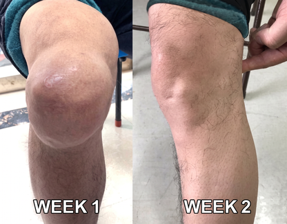 30% Discount🎁🎁|𝐌𝐔𝐑𝐖𝐎𝐍® Bee Venom Pain-Relief Bone Healing Cream ✨✨✨(Specially for older adults)